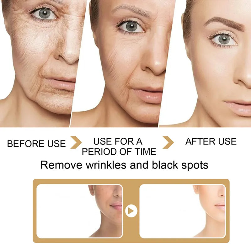 30ml Turmeric Oil Skin To Lightening Acne