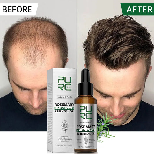 Rosemary Oil Hair Growth Products